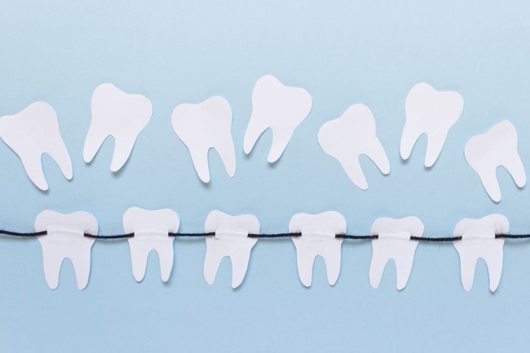 Traumdeutung Zähne Welche Bedeutung Haben Zähne Im Traum? Sinnopedia